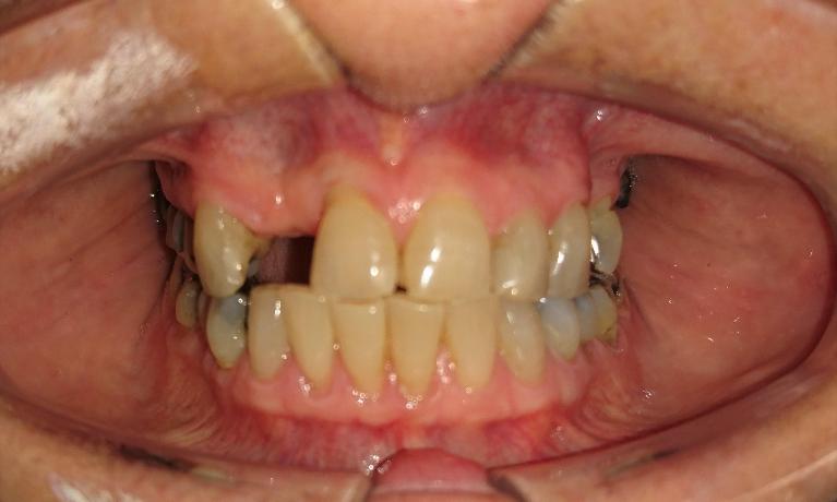 Crown-s-Before-Image